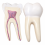 Human-Teeth-Anatomy-Model-Set-12x-Enlarged-3-Tooth-Types